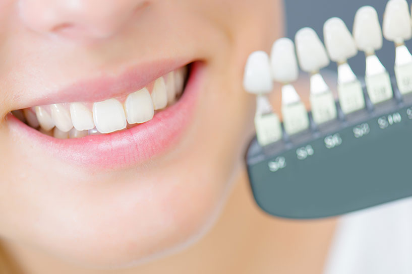 諫早市 たなか歯科医院 デュアルホワイトニング、おすすめです