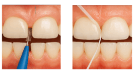 歯間ブラシとデンタルフロス
