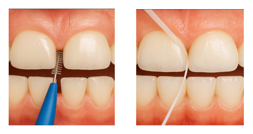 歯間ブラシとデンタルフロス